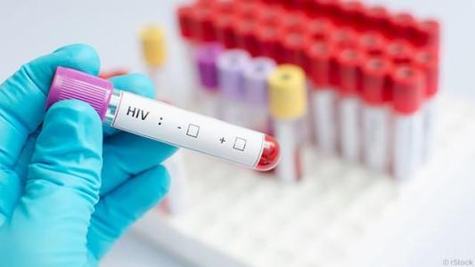 HIV DETECTION