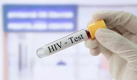 HIV test