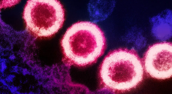 HIV 干细胞移植