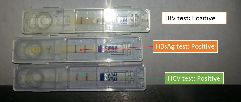 HIV TEST