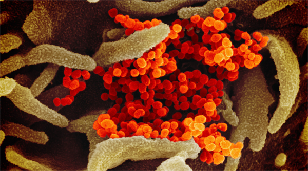 HIV and cancer risk