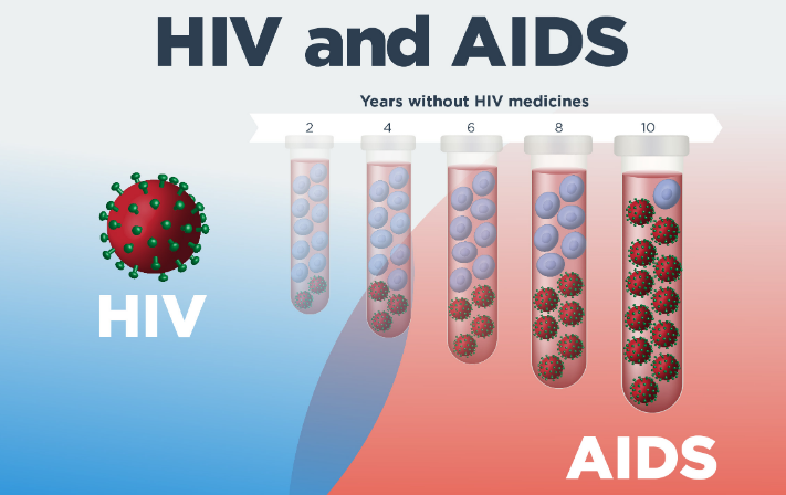 HIV AND LV